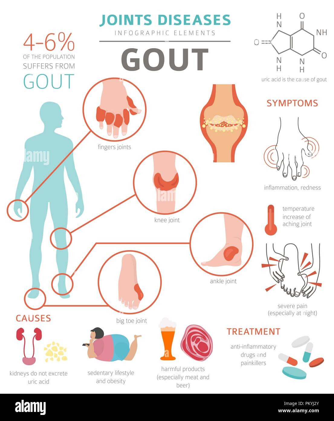 Gout: Joints Diseases  Infographic