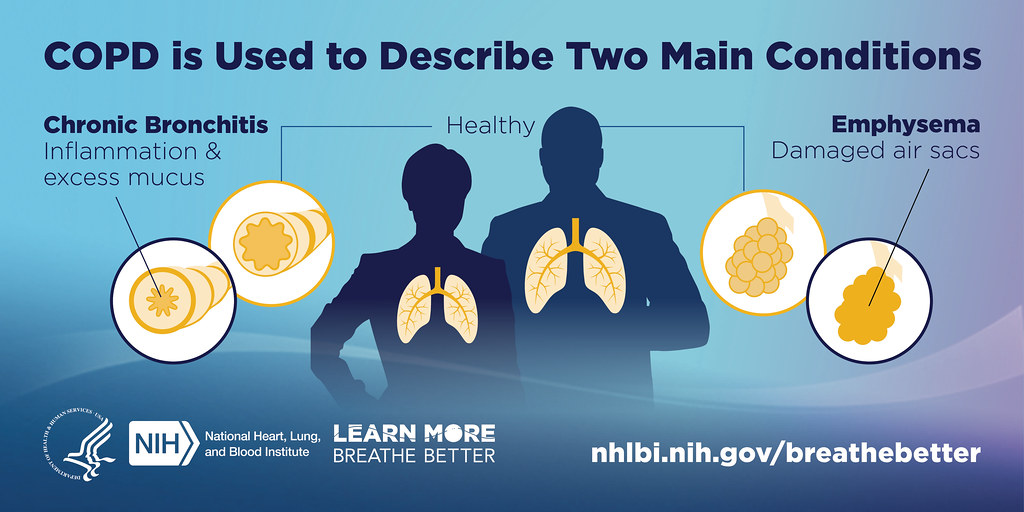 Chronic obstructive pulmonary disease